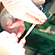 Why Fewer Boys Are Being Circumcised